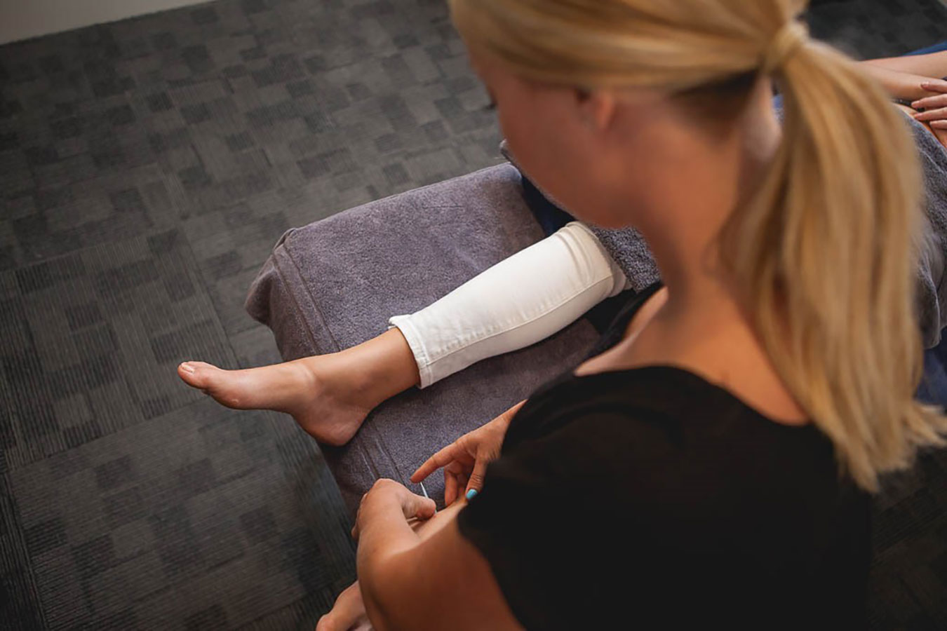 Dry needling acupuncture gold coast acupuncture near me